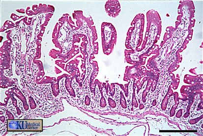 Jejunum / Ileum