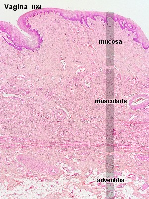 Vaginas histologiske opbygning